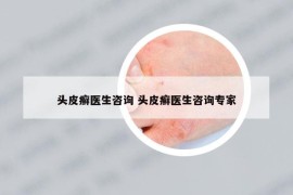 頭皮癬醫(yī)生咨詢 頭皮癬醫(yī)生咨詢專家