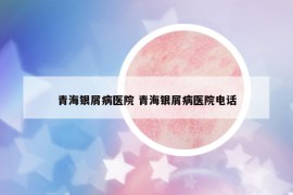 青海銀屑病醫(yī)院 青海銀屑病醫(yī)院電話
