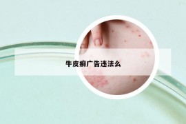 牛皮癬廣告違法么