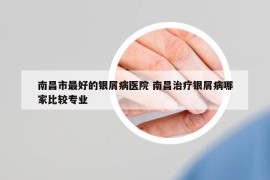 南昌市最好的銀屑病醫(yī)院 南昌治療銀屑病哪家比較專業(yè)