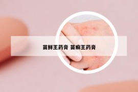 苗鮮王藥膏 苗癬王藥膏