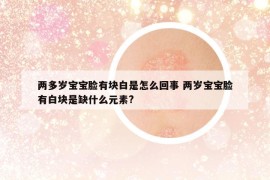 兩多歲寶寶臉有塊白是怎么回事 兩歲寶寶臉有白塊是缺什么元素?