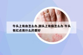 牛頭上有血怎么辦,額頭上有癬怎么辦 牛頭有紅點(diǎn)用什么藥要好