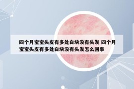 四個(gè)月寶寶頭皮有多處白塊沒(méi)有頭發(fā) 四個(gè)月寶寶頭皮有多處白塊沒(méi)有頭發(fā)怎么回事