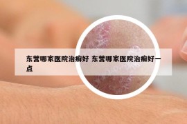 東營哪家醫(yī)院治癬好 東營哪家醫(yī)院治癬好一點(diǎn)