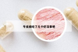 牛皮癬吃了幾個蝦沒事吧