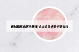 運城銀屑病醫(yī)院新聞 運城銀屑病醫(yī)學研究院