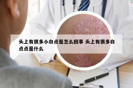 頭上有很多小白點(diǎn)是怎么回事 頭上有很多白點(diǎn)點(diǎn)是什么