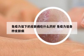 免疫力低下的皮膚病吃什么藥好 免疫力低各種皮膚病