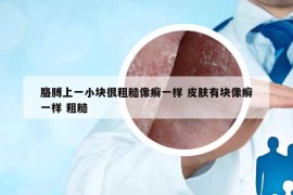 胳膊上一小塊很粗糙像癬一樣 皮膚有塊像癬一樣 粗糙