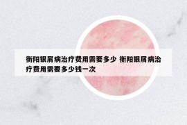 衡陽銀屑病治療費(fèi)用需要多少 衡陽銀屑病治療費(fèi)用需要多少錢一次