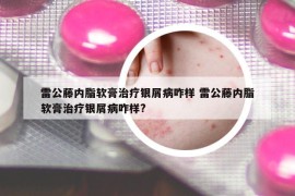 雷公藤內(nèi)脂軟膏治療銀屑病咋樣 雷公藤內(nèi)脂軟膏治療銀屑病咋樣?