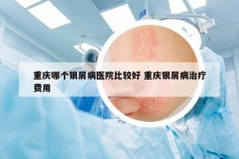 重慶哪個(gè)銀屑病醫(yī)院比較好 重慶銀屑病治療費(fèi)用