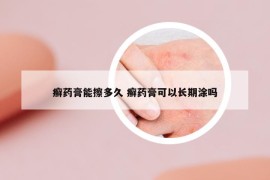 癬藥膏能擦多久 癬藥膏可以長期涂嗎