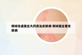 桐城交通夏莊大藥房治皮膚病 桐城夏莊看皮膚病