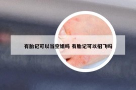 有胎記可以當(dāng)空姐嗎 有胎記可以招飛嗎