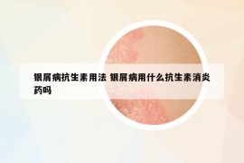銀屑病抗生素用法 銀屑病用什么抗生素消炎藥嗎