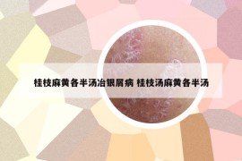 桂枝麻黃各半湯冶銀屑病 桂枝湯麻黃各半湯
