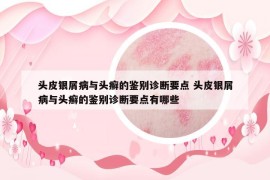 頭皮銀屑病與頭癬的鑒別診斷要點(diǎn) 頭皮銀屑病與頭癬的鑒別診斷要點(diǎn)有哪些