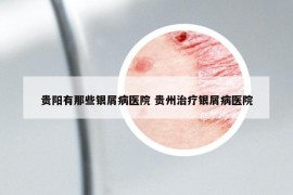 貴陽(yáng)有那些銀屑病醫(yī)院 貴州治療銀屑病醫(yī)院