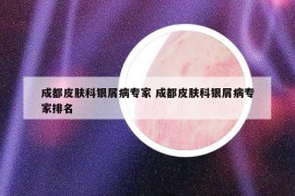 成都皮膚科銀屑病專(zhuān)家 成都皮膚科銀屑病專(zhuān)家排名