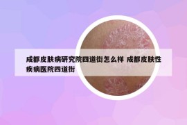 成都皮膚病研究院四道街怎么樣 成都皮膚性疾病醫(yī)院四道街