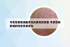 尋常型銀屑病最常見的原發(fā)性損害 尋常型銀屑病的特征性表現為