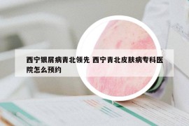 西寧銀屑病青北領(lǐng)先 西寧青北皮膚病?？漆t(yī)院怎么預(yù)約