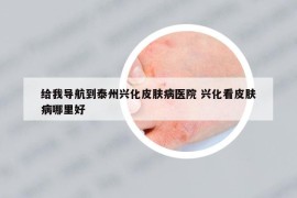給我導(dǎo)航到泰州興化皮膚病醫(yī)院 興化看皮膚病哪里好