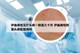伊曲康唑治療頭癬一般是幾個月 伊曲康唑膠囊頭癬能服用嗎