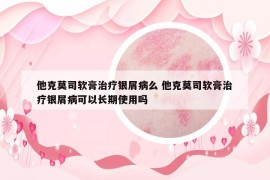 他克莫司軟膏治療銀屑病么 他克莫司軟膏治療銀屑病可以長(zhǎng)期使用嗎
