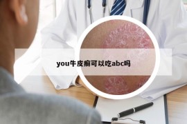 you牛皮癬可以吃abc嗎