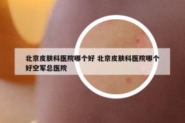 北京皮膚科醫(yī)院哪個好 北京皮膚科醫(yī)院哪個好空軍總醫(yī)院