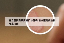 省立醫(yī)院有銀屑病門診部嗎 省立醫(yī)院皮膚科專家門診