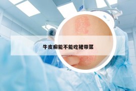 牛皮癬能不能吃裙帶菜