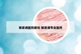 銀屑病醫(yī)院廊坊 銀屑病專業(yè)醫(yī)院