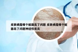 皮膚病是哪個(gè)臟器出了問題 皮膚病是哪個(gè)臟器出了問題神經(jīng)性皮炎