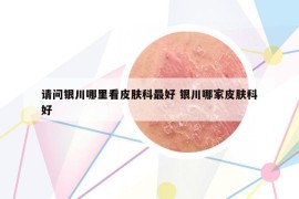 請問銀川哪里看皮膚科最好 銀川哪家皮膚科好