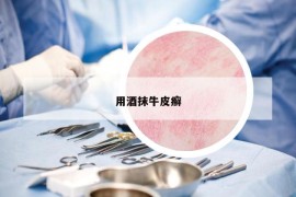 用酒抹牛皮癬