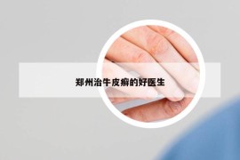 鄭州治牛皮癬的好醫(yī)生