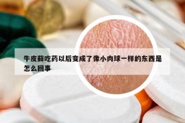 牛皮蘚吃藥以后變成了像小肉球一樣的東西是怎么回事