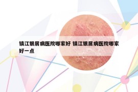 鎮(zhèn)江銀屑病醫(yī)院哪家好 鎮(zhèn)江銀屑病醫(yī)院哪家好一點(diǎn)