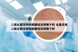 二硫化硒洗劑和酮康唑洗劑哪個好 毛囊炎用二硫化硒洗劑和酮康唑洗劑哪個好