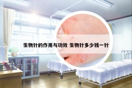 生物針的作用與功效 生物針多少錢一針