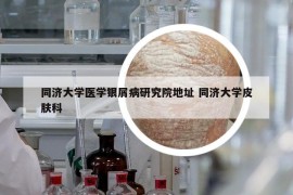 同濟(jì)大學(xué)醫(yī)學(xué)銀屑病研究院地址 同濟(jì)大學(xué)皮膚科