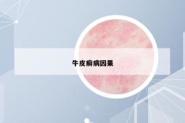 牛皮癬病因果