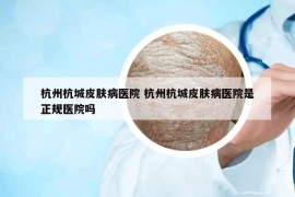 杭州杭城皮膚病醫(yī)院 杭州杭城皮膚病醫(yī)院是正規(guī)醫(yī)院嗎