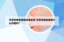 尋常型銀屑病慎用或禁用 尋常型銀屑病用什么藥最好?