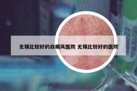 無(wú)錫比較好的白癜風(fēng)醫(yī)院 無(wú)錫比較好的醫(yī)院