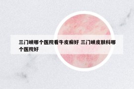 三門峽哪個醫(yī)院看牛皮癬好 三門峽皮膚科哪個醫(yī)院好
